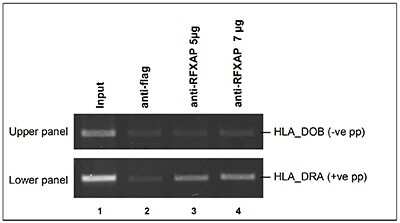 Chromatin Immunoprecipitation: RFXAP Antibody [NBP3-18683] - Figure 1 ChIP results obtained with the antibody directed against RFXAP ChIP assays were performed using NALM cells (a cell line derived from human pre-B leukemia), the antibody against RFXAP and optimized primer sets for PCR. Sheared chromatin from 2 million cells and respectively 5 and 7 ug of antibody were used per ChIP experiment. An anti-flag antibody (lane 2) was used as negative IP control. Figure 1 shows the result of the end-point PCR with primers for HLA_DRA, used as positive control (lower panel) and for HLA_DOB, used a negative PCR control (upper panel).